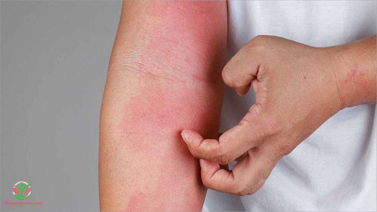 Allergie visage rouge chaud causes symptômes et traitements