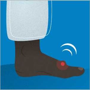 Bosse sur le pied causes symptômes et traitements