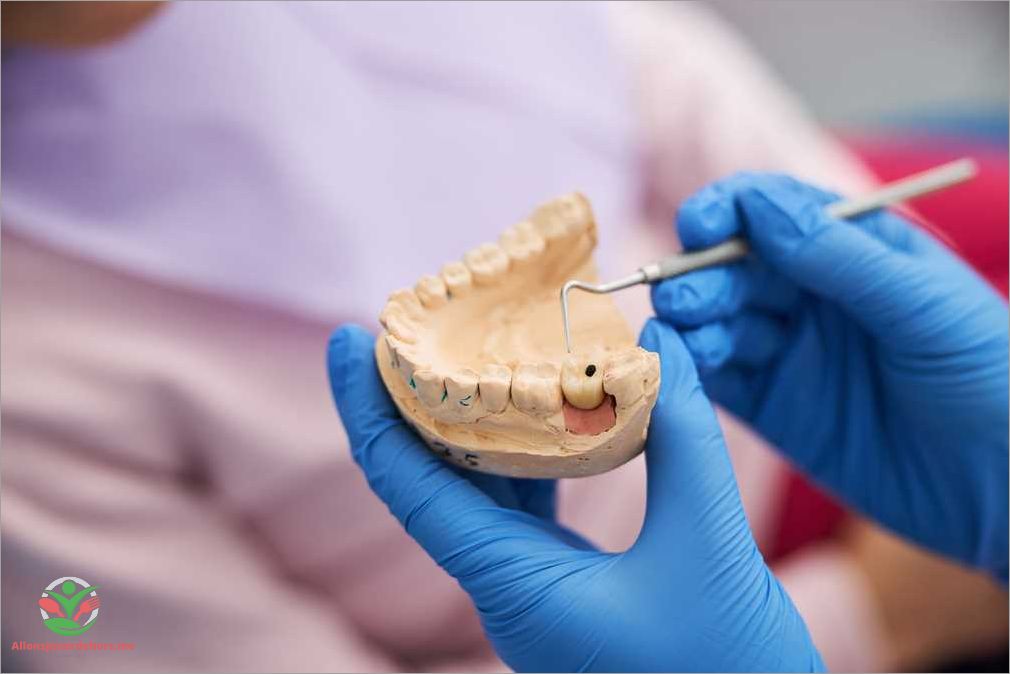 Problèmes dentaires courants : comment les identifier et les traiter