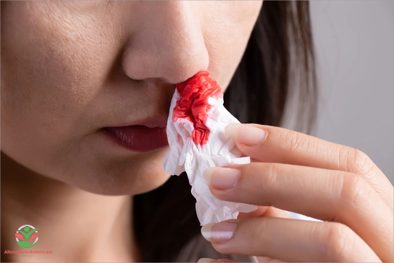 Causes courantes de saignement de nez