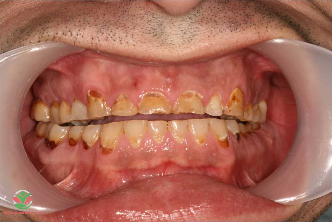 Structure de la dent de devant