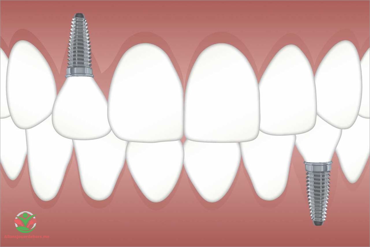 Visites régulières chez le dentiste pour la dent de devant
