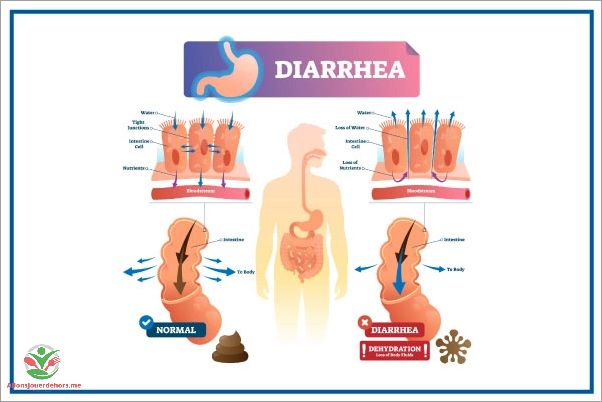 Conseils pour prévenir la diarrhée