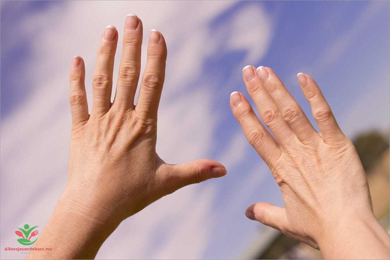 Causes possibles du gonflement du doigt