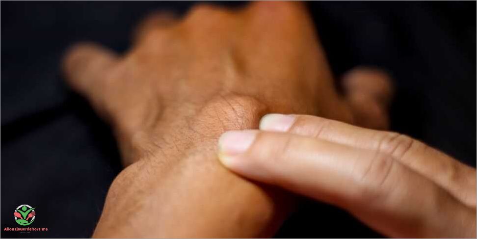 Douleur au poignet causes symptômes et traitements