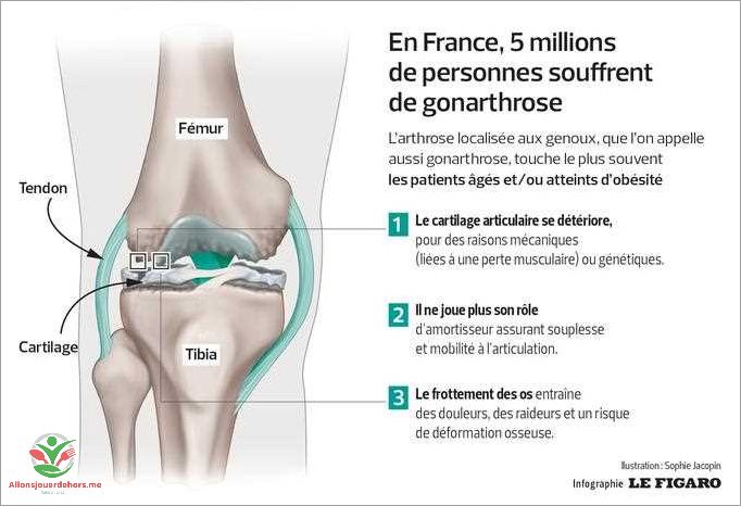 Causes possibles de la douleur au genou gauche sans raison apparente