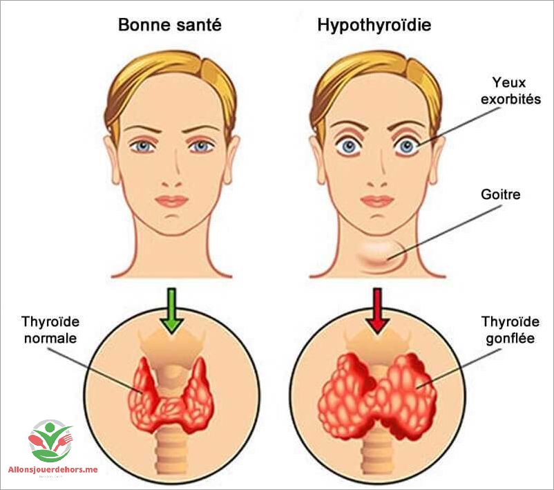 Problèmes de thyroïde et poids  causes symptômes et solutions
