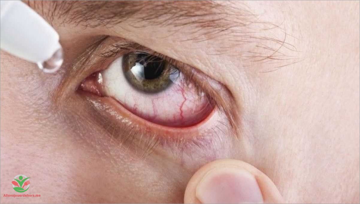 Causes du sang dans l'oeil