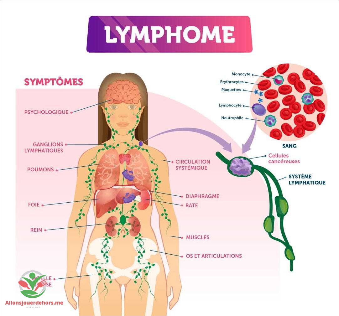 Le lymphome est-il mortel  Découvrez tout ce que vous devez savoir