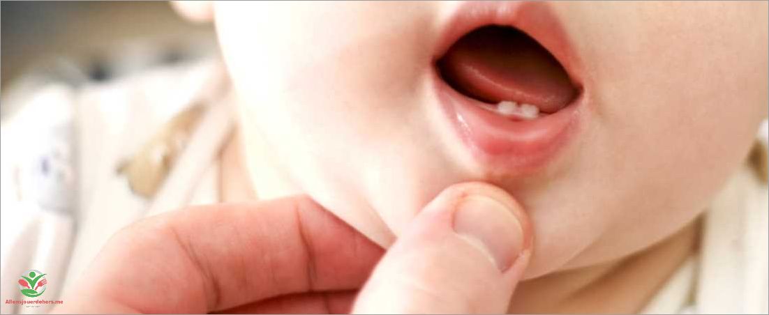 Symptômes de la poussée dentaire chez le bébé tout ce que vous devez savoir